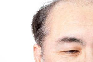 サロンの陶肌トリートメントを自宅で実現